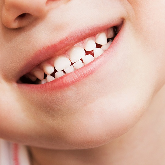 Closeup of child's smile after tooth colored filling placement